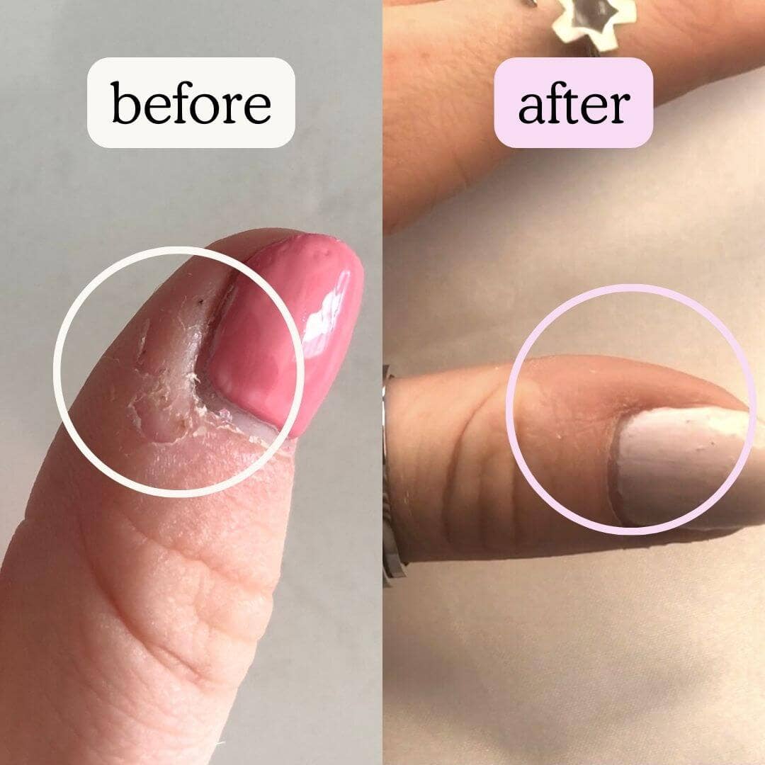 Calm Gold Heart stressisormus